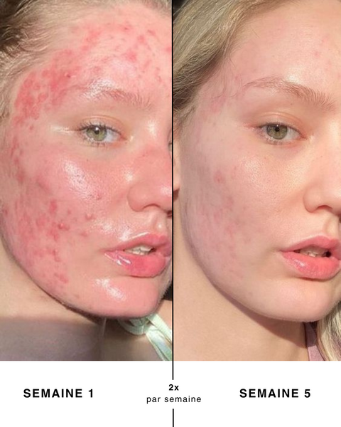 Routine Masques K-LAB