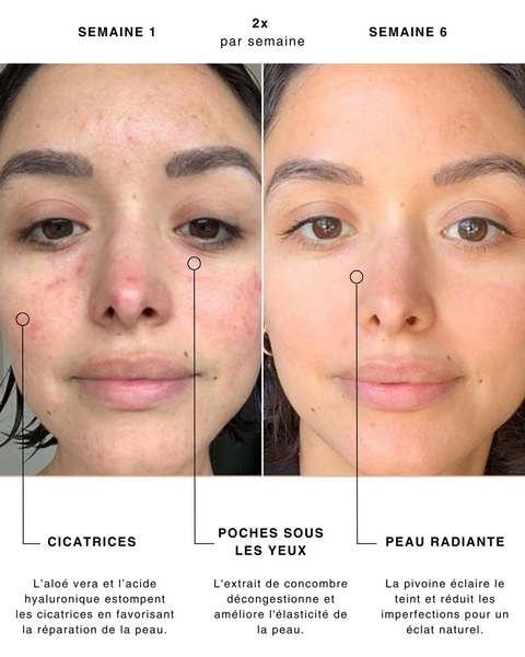 Routine Masques K-LAB